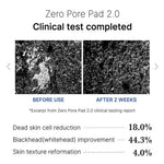 Medicube Zero Pore Pad