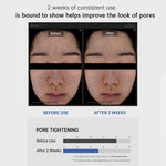 Medicube Zero Pore Pad