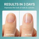 Nail Care Oil Cuticle Treatment