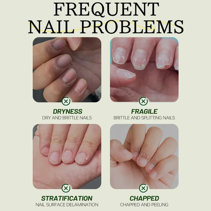 Nail Care Oil Cuticle Treatment